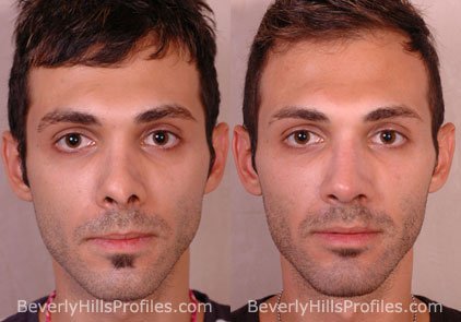 Profiles Beverly Hills