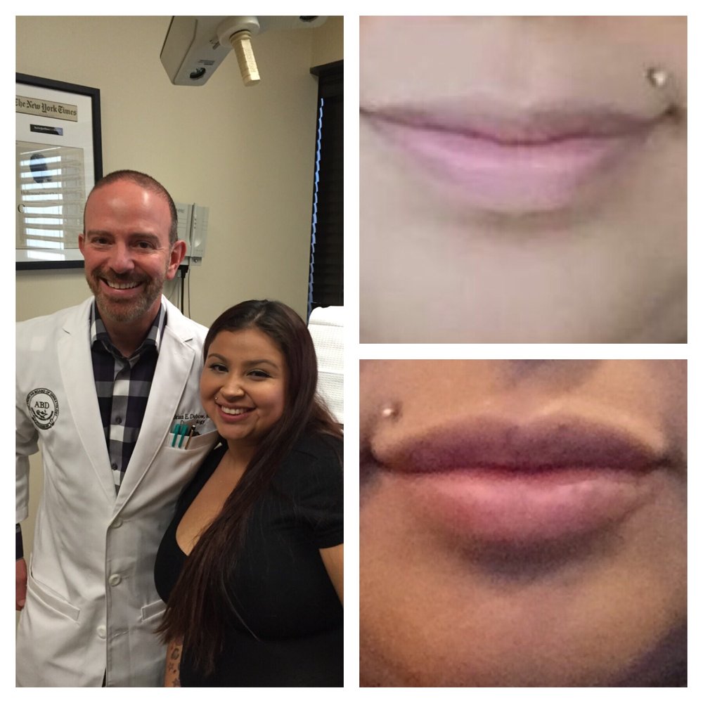 Brian E Dubow, MD