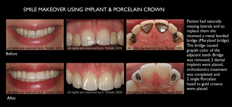 Arman Torbati, DDS, FACP