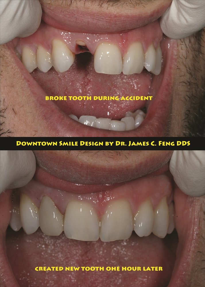 Downtown Smile Design - James C Feng, DDS