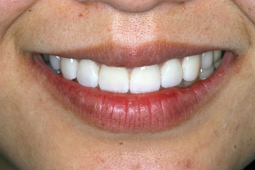 Angel Dental Group