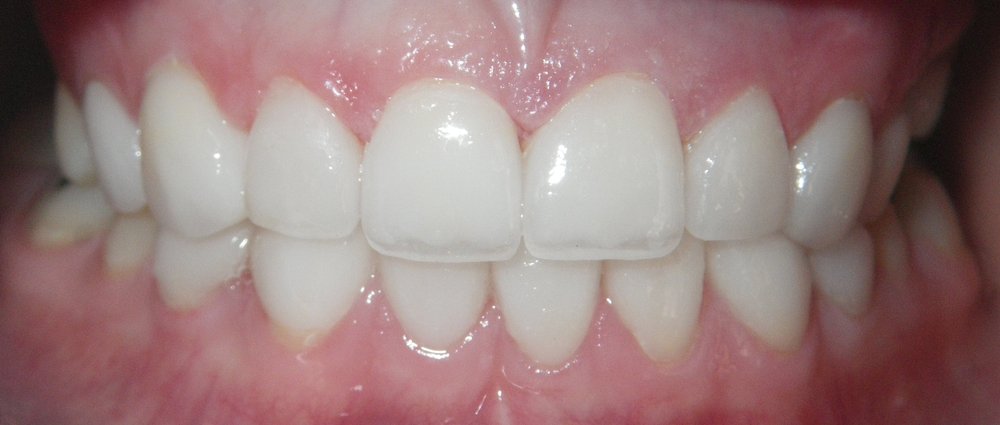 LA Dental Clinic